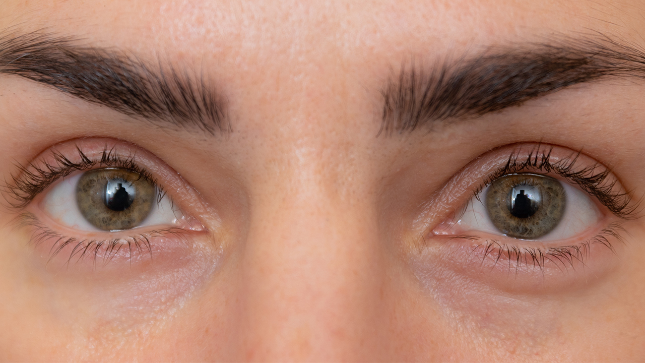 长期用散瞳药会诱发开角型青光眼吗