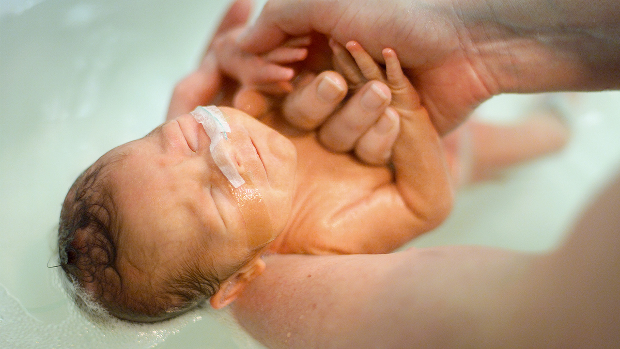 新生儿黄疸病理性要重视 宝宝黄疸病理性要重视