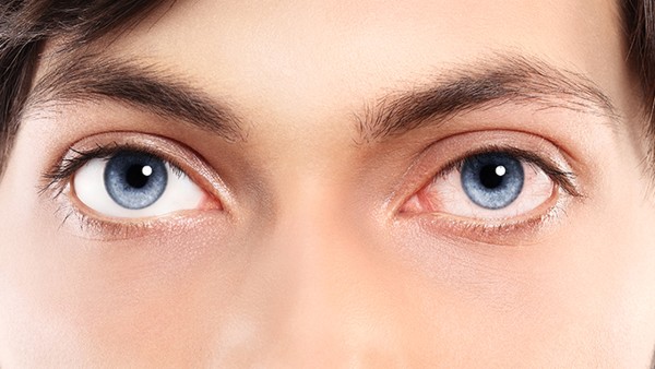 怎样预防干眼症复发
